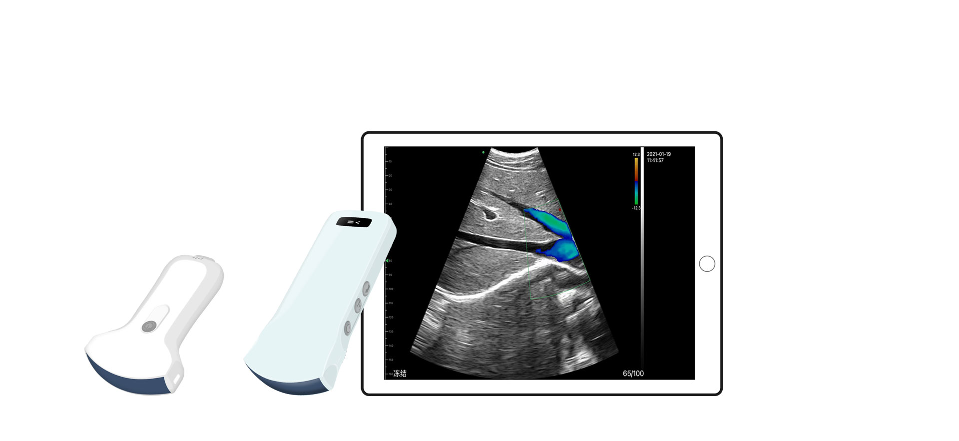 What Are the Clinical Applications of Abdominal Ultrasound Probes?