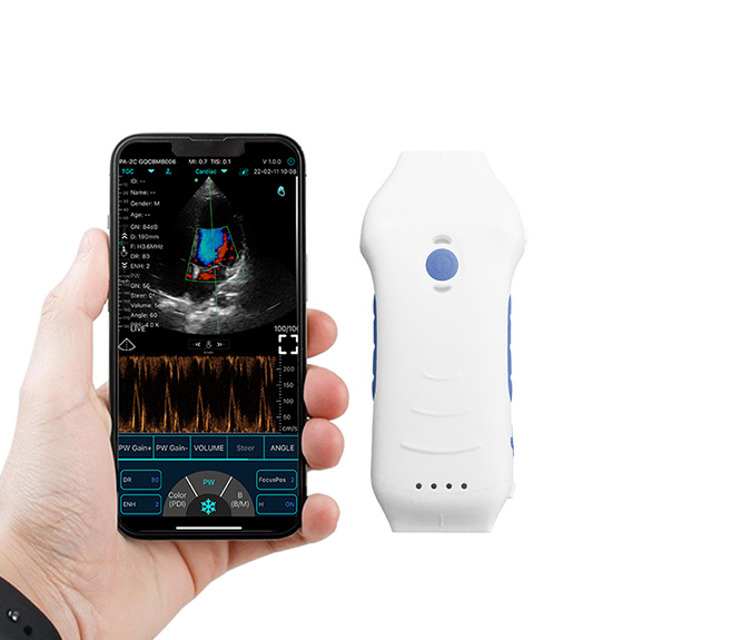 Applications of WiFi Ultrasound Probe in Neurosurgery