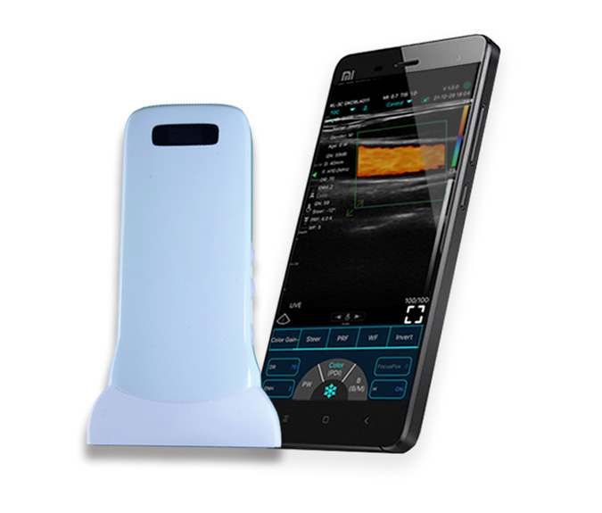 Applications of Handheld Wireless Ultrasound Probes in Anesthesiology