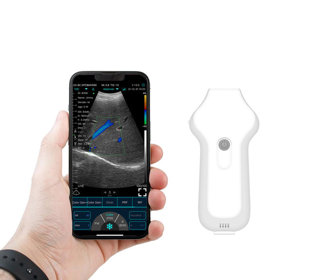 Application of Wireless Ultrasound Scanners in General Surgery