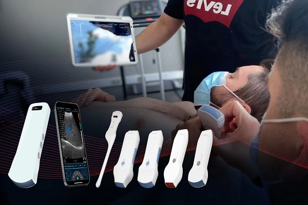 Wireless Ultrasound Probe: A Revolutionary Tool in the Medical Field