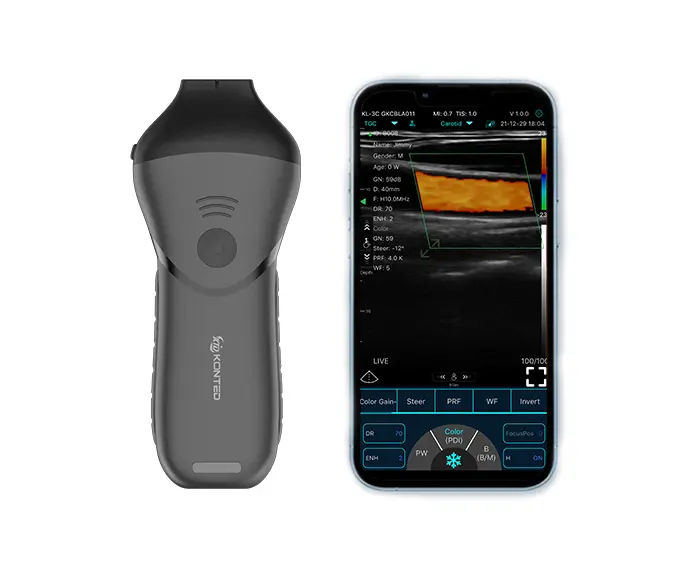 handheld ultrasound c10mb pro2