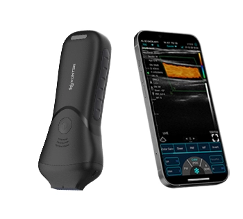 C10MS Pro USB&Wifi High Linear Ultrasound Probe