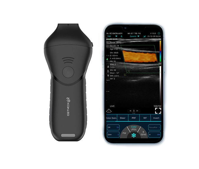 Innovative Features and Technology of the Latest Abdomen Ultrasound Convex Probes