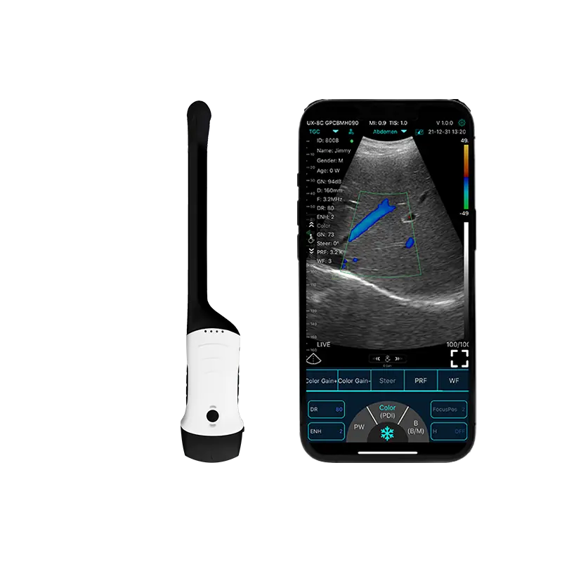 The Portable Handheld Ultrasound Scanner Opens a New Era in Medical Examination