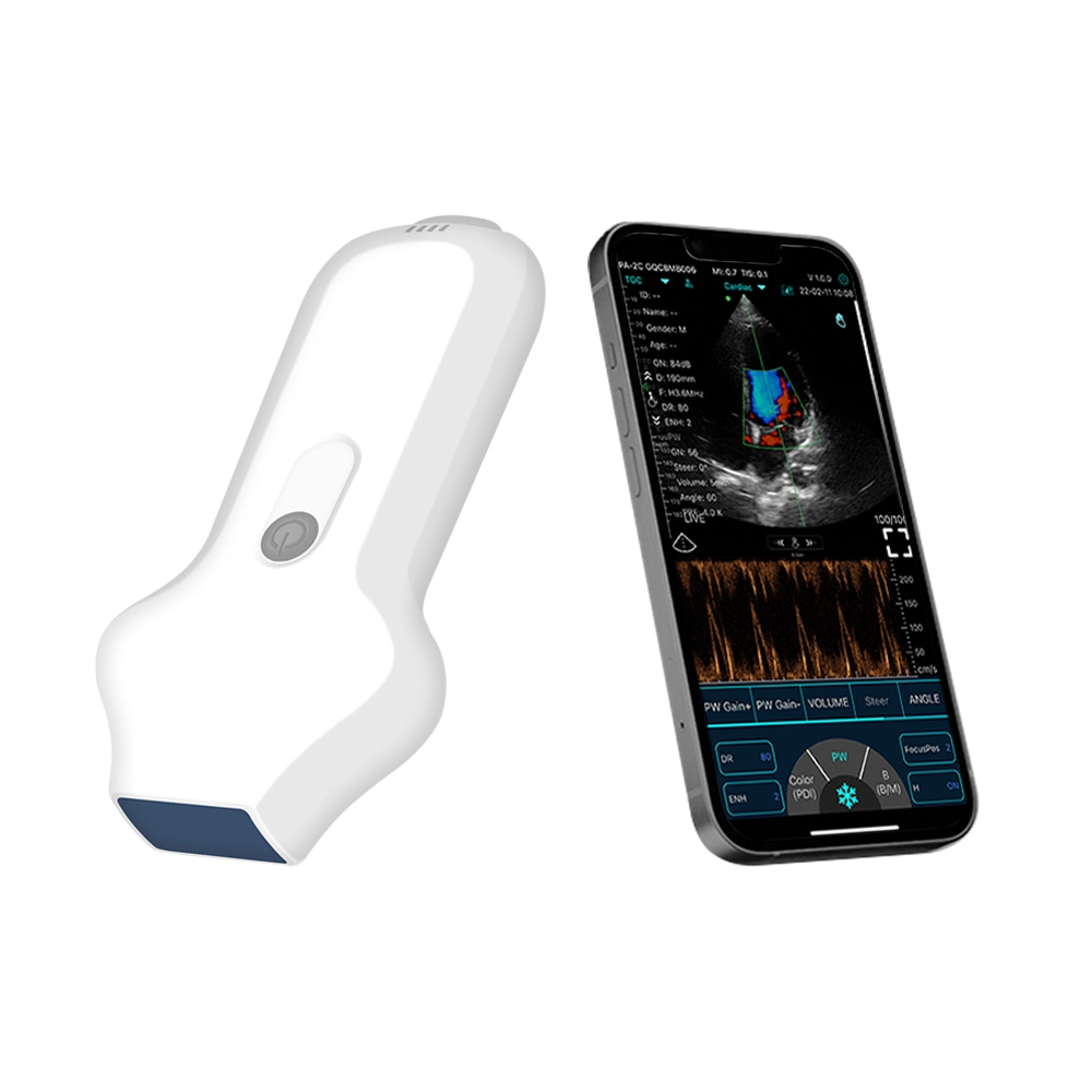 How to Choose a Portable Ultrasound Device?