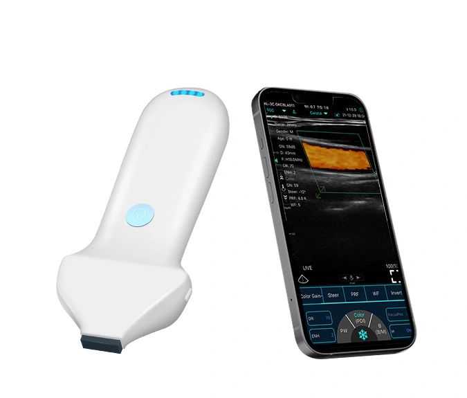 Clinical Applications of Ultrasound Colour Doppler