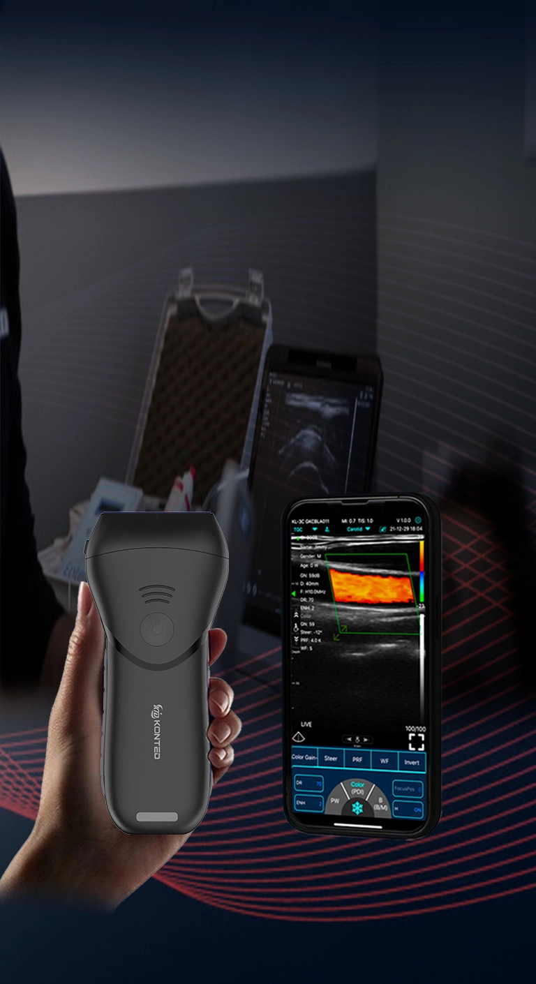 START YOUR HANDHELD ULTRASOUND, EASY TO USE, ANYTIME, ANYWHERE