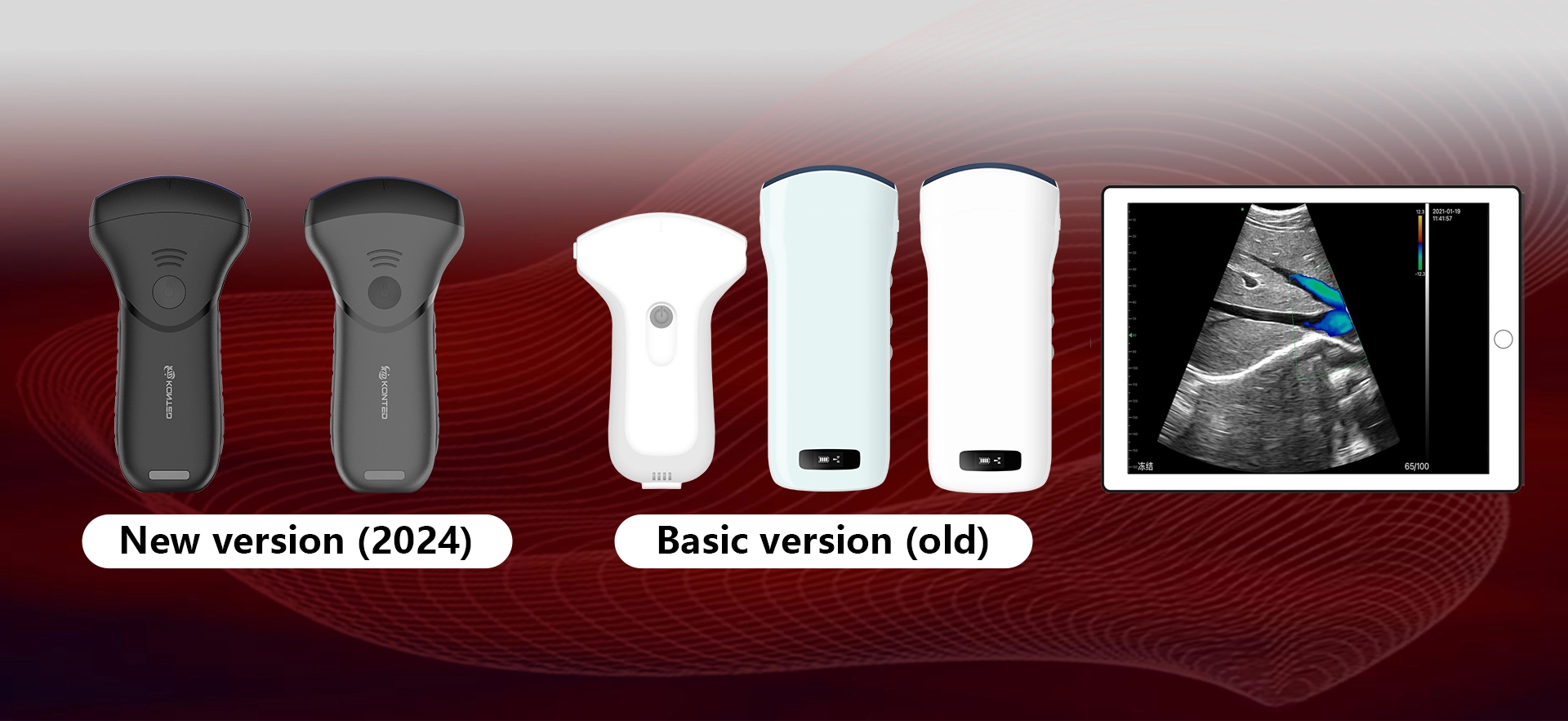 Abdomen Ultrasound Convex Probes