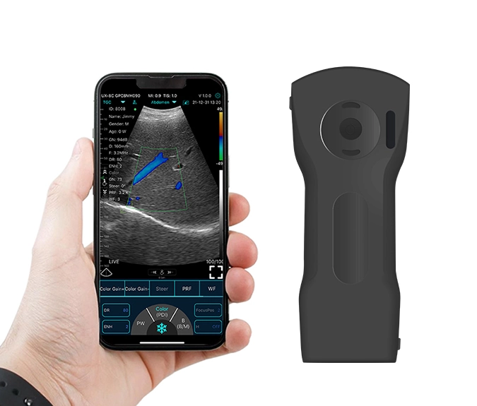 c10xs handheld ultrasound3