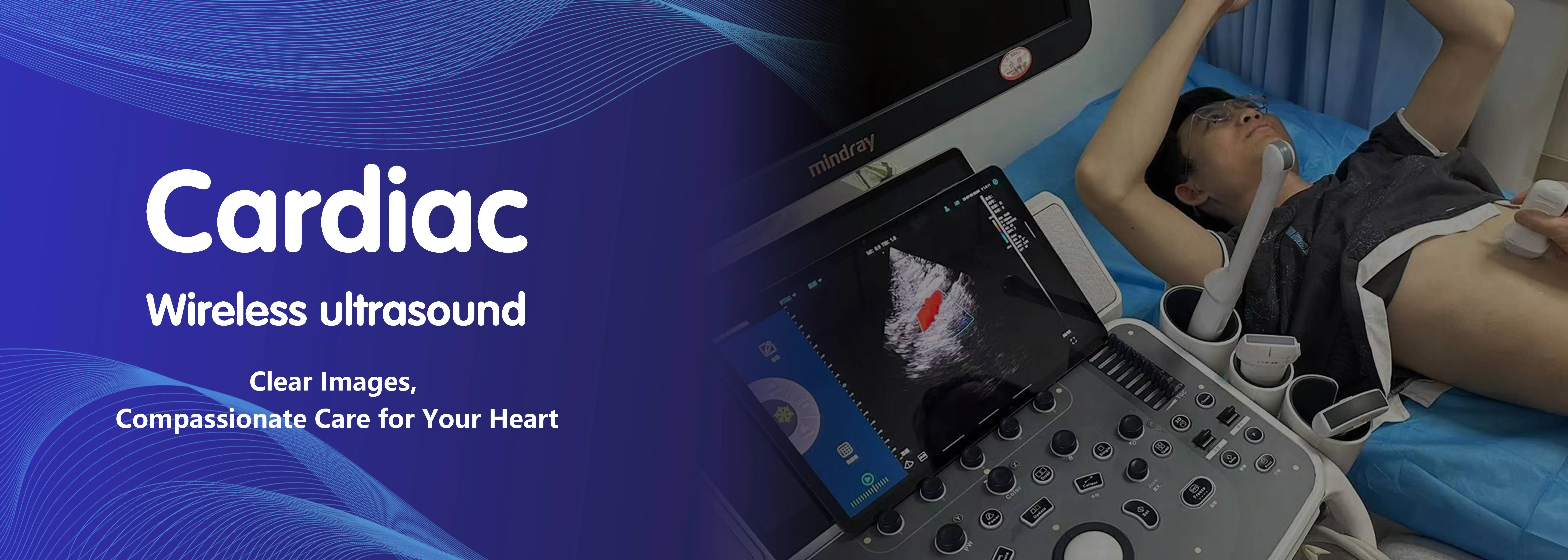 Cardiac wireless ultrasound probe